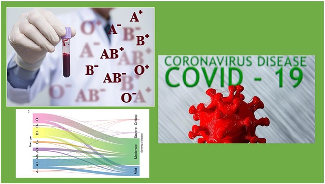 Evaluation of the Relationship between ABO Blood Groups and Severity and Mortality in Patients with Covid-19 
