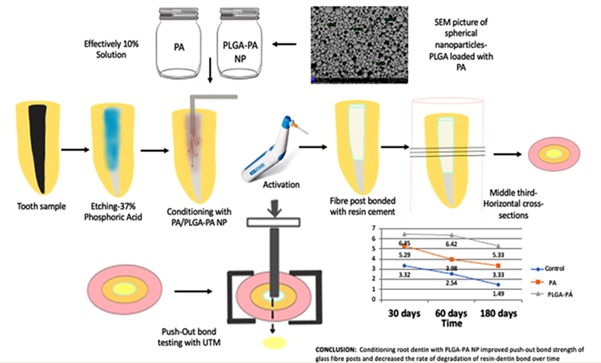 Development, Characterization, and Influence of Proanthocyanidin Loaded PLGA Nanoparticles on Push out Bond Strength of Glass Fibre Posts Bonded with Resin Cement to Root Dentin: In Vitro Study 