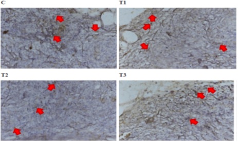 The Ethanolic Extract of Basic Leaves (Ocimum basilicum) Effect on Expression of Follicle Stimulating Hormone Receptors (FSHr) and Folliculogenesis in Female Mice Model Endometriosis 