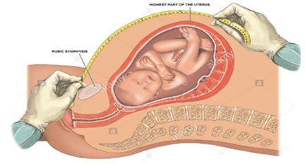 Evaluation of the Fetal Thigh Cross-Section to Predict Fetal Birth Weight in Normal-Term Pregnant Women 