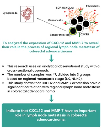 Correlation between CXCL12 and MMP-7 Expression with Lymph Node Metastasis Status in Colorectal Adenocarcinoma 